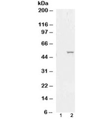 Western blot of HEK293 lysate overexpressing ALDH1A1 probed with ALDH1 antibody (mock transfection in lane 1). Predicted molecular weight ~55kDa.