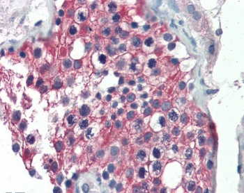IHC testing of FFPE human testis tissue with ALDH1 antibody at 5ug/ml. Required HIER: steamed antigen retrieval with pH6 citrate buffer; AP-staining.