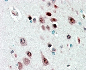 IHC staining of FFPE human cerebral cortex with NOVA1 antibody at 2.5ug/ml. HIER: steamed with pH6 citrate buffer, AP-staining.