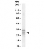 Western blot testing of human heart lysate with PEBP4 antibody at 1ug/ml. Both the expected ~26kDa band and the additional ~30kDa band are blocked by the immunizing peptide.