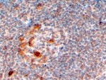 IHC testing of FFPE human lymph node with ZCCHC11 antibody at 4ug/ml. HIER: steamed with pH6 citrate buffer, HRP-staining.