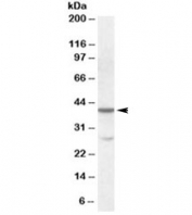 Western blot testing of K562 lysate with CBX8 antibody at 0.1ug/ml. The expected ~40kDa band and the additional ~28kDa band are both blocked by the immunizing peptide.