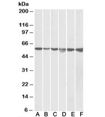 Western blot testing of HeLa (A), A431 (B), A549 (C), MCF7 (D), Jurkat (E) and K562 (F) lysates with GPI antibody at 0.05ug/m