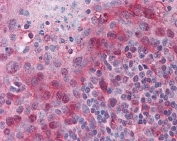 IHC staining of FFPE human tonsil with TMS1 antibody at 2.5ug/ml. HIER: steamed with pH6 citrate buffer, AP-staining.