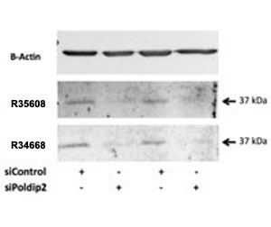 Western blot testing of rat VSMC lysate with POLDIP2 antibody at 0.5ug/ml (Cat # R35068 and <a href=../tds/poldip2-antibody-r34668>R34668</a>). Signal is reduced by specific siRNA but not control.