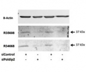 Western blot testing of rat VSMC lysate with POLDIP2 antibody at 0.5ug/ml (Cat # R35068 and R34668). Signal is reduced by specific siRNA but not control.