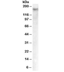 Western blot testing of Jurkat cell lysate with Dnmt1 antibody at 0.5ug/ml. Predicted molecular weight: 180-200kDa~