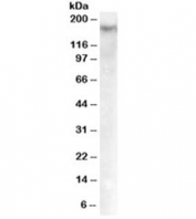 Western blot testing of Jurkat cell lysate with Dnmt1 antibody at 0.5ug/ml. Predicted molecular weight: 180-200kDa