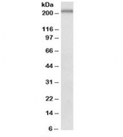 Western blot testing of mouse spleen lysate with Dennd4c antibody at 0.5ug/ml. Predicted molecular weight: ~211kDa.