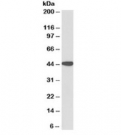Western blot testing of human kidney lysate with AMACR antibody at 0.1ug/ml. Predicted molecular weight ~43kDa.