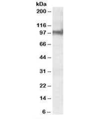 Western blot testing of mouse heart lysate with Plakophilin 2 antibody at 0.3ug/ml. Predicted molecular weight: ~88kDa.