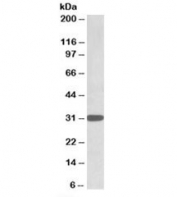 Western blot testing of K562 lysate with TIPRL antibody at 1ug/ml. Predicted/observed molecular weight: ~31kDa.