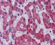 IHC testing of FFPE human liver with SCD1 antibody at 5ug/ml. HIER: steamed with pH6 citrate buffer, AP-staining.