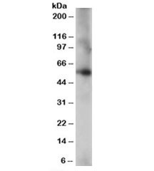 Western blot testing of human lung lysate with CORO1C antibody at 0.2ug/ml. Predicted molecular weight: ~53kDa.