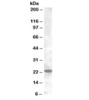 Western blot testing of mouse kidney lysate with Rab17 antibody at 0.2ug/ml. Predicted/observed molecular weight: ~23kDa.