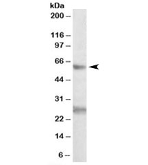 Western blot testing of K562 lysate with EIF2B4 antibody at 0.3ug/ml. Predicted/observed molecular weight: ~60/60-67kDa. Both observed bands are blocked by the immunizing peptide.