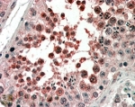 IHC staining of FFPE human testis with ACVR1 antibody at 4ug/ml. HIER: steamed with pH6 citrate buffer, AP-staining.