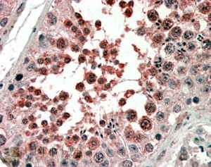 IHC staining of FFPE human testis with ACVR1 antibody at 4ug/ml. HIER: steamed with pH6 citrate buffer, AP-staini