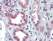 IHC testing of FFPE human kidney tissue with SNAIL antibody at 5ug/ml. Required HIER: steamed antigen retrieval with pH6 citrate buffer; AP-staining.