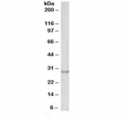 Western blot testing of human A431 lysate with SNAIL antibody at 0.1ug/ml. Predicted molecular weigth ~29 kDa.