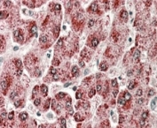 IHC staining of FFPE human liver with CYP2E1 antibody at 4ug/ml. HIER: steamed with pH6 citrate buffer, AP-staining.
