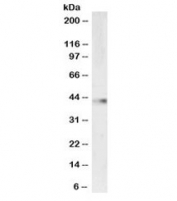 Western blot testing of mouse thymus lysate with VASP antibody at 1ug/ml. Observed molecular weight: ~46/50kDa (unmodified/phosphorylated).