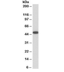Western blot testing of human platelet lysate with VASP antibody at 0.01ug/ml. Observed molecular weight: ~46/50kDa (unmodified/phosphorylated).