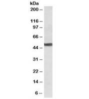 Western blot testing of human liver lysate with CYP24A1 antibody at 0.1ug/ml. Predicted molecular weight: ~51kDa.