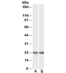 Western blot testing of mouse [A] and rat [B] eye lysates with CRYAB antibody at 0.05ug/ml. Predicted molecular weight: ~20kDa.