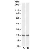 Western blot testing of mouse [A] and rat [B] eye lysates with CRYAB antibody at 0.05ug/ml. Predicted molecular weight: ~20 kDa.