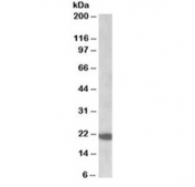 Western blot testing of rat intestine lysate with NRAS antibody at 0.1ug/ml. Predicted molecular weight ~21 kDa.