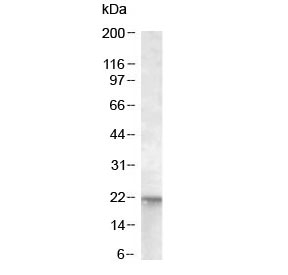 Western blot of A431 lysate with NRAS antibody at 0.01ug/ml. Predicted molecular weight ~21 kDa.