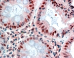 IHC staining of FFPE human colon with MBD2 antibody at 2.5ug/ml. HIER: steamed with pH6 citrate buffer, AP-staining.