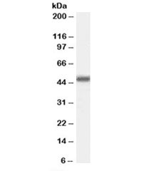 Western blot testing of Jurkat cell lysate with MBD2 antibody at 0.3ug/ml. Predicted/observed molecular weight: ~47kDa.~