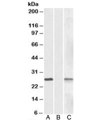 Western blot of HEK293 lysate overexpressing human DYDC1-MYC lysate (Lane A) and mock-transfected lysate (Lane B) with DYDC1 antibody at 1ug/ml. Lane C - same transfected lysate tested with anti-MYC tag (1:1000). Predicted molecular weight: ~21/22kDa (isoforms 1/2).