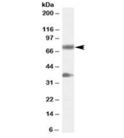 Western blot testing of human cerebellum lysate with NRG3 antibody at 0.3ug/ml. The expected ~75kDa band and the additional ~37kDa band are both blocked by the immunizing peptide.