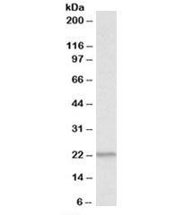 Western blot testing of human thymus lysate with PSMB9 antibody at 1ug/ml. Predicted molecular weight: ~23kDa.~