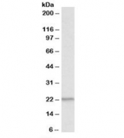 Western blot testing of human thymus lysate with PSMB9 antibody at 1ug/ml. Predicted molecular weight: ~23kDa.