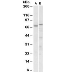 Western blot of mouse (A) and rat (B) heart lysate with p63 antibody at 0.3ug/ml. Expected molecular weight: ~77kDa.