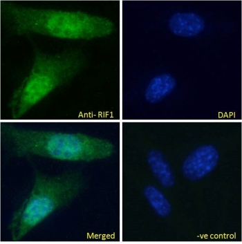 IF/ICC staining of fixed and permeabilized mouse NIH 3T3 cells with RIF1 antibody (green) at 10ug/ml and DAPI nuclear stain (blue).