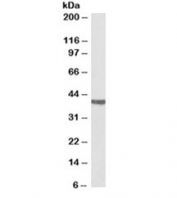 Western blot testing of rat heart lysate with CTnT antibody at 0.03ug/ml