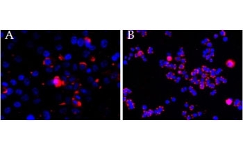 ICC: CEP290 antibody (2.5ug/ml) overnight staining of cell lines OPCT-1 [A] and MDA468 [B] with Alexa Fluor 568 [red] and nuclear counter staining with DAPI [blue].