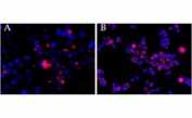 CEP290 antibody (2.5ug/ml) overnight staining of cell lines OPCT-1 [A] and MDA468 [B] with Alexa Fluor 568 [red] and nuclear counter staining with DAPI [blue].