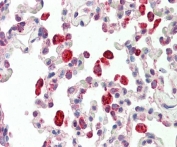 IHC testing of FFPE human lung tissue with Cathepsin C antibody at 5ug/ml. Required HIER: steamed antigen retrieval with pH6 citrate buffer; AP-staining.