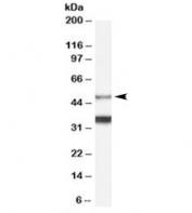 Western blot testing of human brain lysate with Orexin receptor antibody at 0.1ug/ml. Predicted molecular weight ~48kDa.