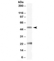 Western blot testing of human ovay lysate with Fibulin 5 antibody at 0.1ug/ml. The expected ~50kDa band and the additional ~23kDa band are both blocked by the immunizing peptide.