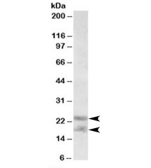 Western blot testing of human prostate lysate with IL-25 antibody at 0.3ug/ml. Predicted molecular weight: ~18/21-26kDa (unmodified/glycosylated).