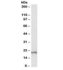 Western blot testing of MOLT4 lysate with eIF5A antibody at 0.1ug/ml. Predicted molecular weight: ~20kDa.