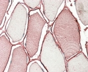 IHC staining of FFPE human skeletal muscle with TRIM72 antibody at 4ug/ml. HIER: steamed with pH6 citrate buffer, AP-staining.