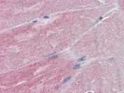 IHC testing of FFPE human skeletal muscle tissue with IGFBP6 antibody at 5ug/ml. Required HIER: steamed antigen retrieval with pH6 citrate buffer; AP-staining.